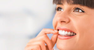 Lingual Braces or Invisalign: Which is best for you? | South East Orthodontics