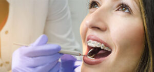 taking care of your braces