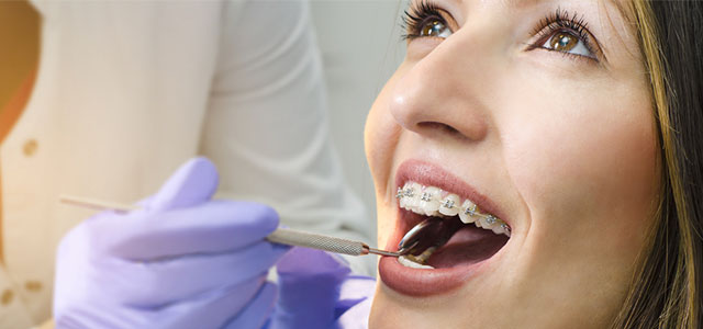 taking care of your braces